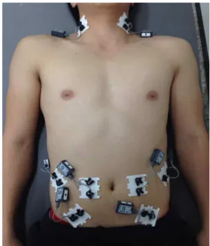Figure  1.  Electrode placements of rectus abdominis, external and internal oblique, and sternocleidomastoid muscles.