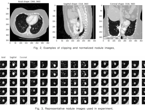 Fig. 3. Representative nodule images used in experiment.