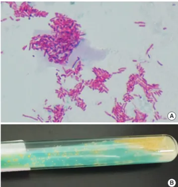 Fig. 6. Findings of bronchoalveolar lavage fluid. Nontuberculous Mycobacteri- Mycobacteri-um was found in sputMycobacteri-um acid fast bacillus (AFB) stain (A) and culture (B)