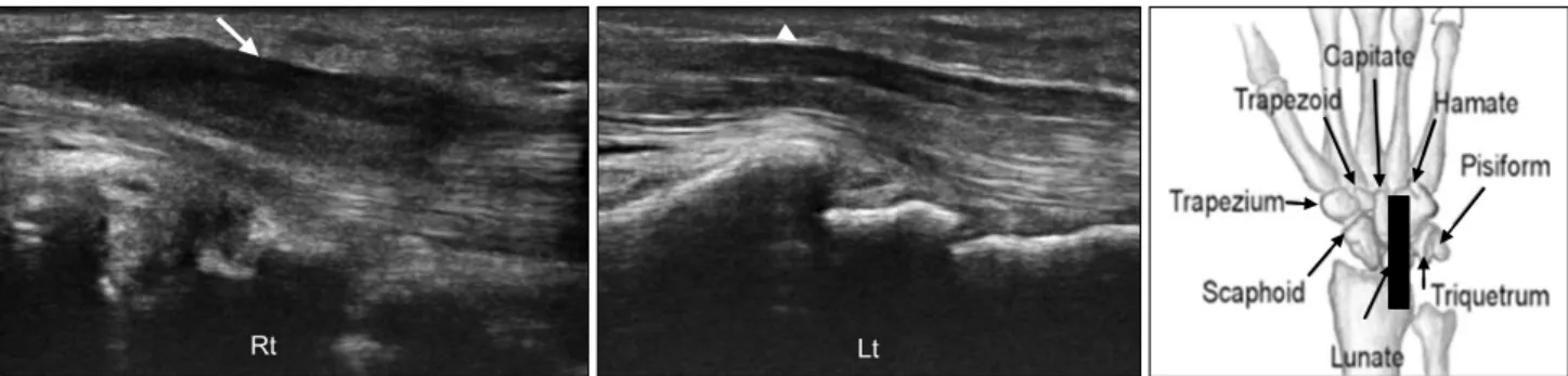Table  1.  Findings  of  Electrodiagnostic  Study