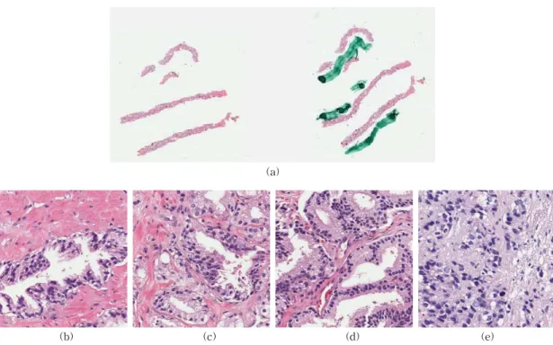 Fig. 1. Provided original images and actually used prostate cancer pathology images. (a) Original, (b) Grade 1 &amp; 