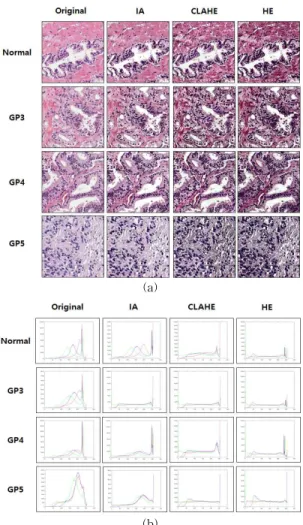 Fig. 4. Observe the original image, after contrast en- en-hancement and the changes in each image
