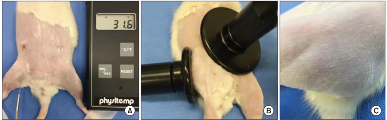 Fig.  1.  Tissue  temperature  was  measured  from  skin  surface  to  1  cm  depth  (A)