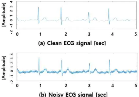 Fig. 3. (a) Result of clean ECG signal wavelet transform, (b) Result of power line noise contaminated ECG signal  wavelet transform.
