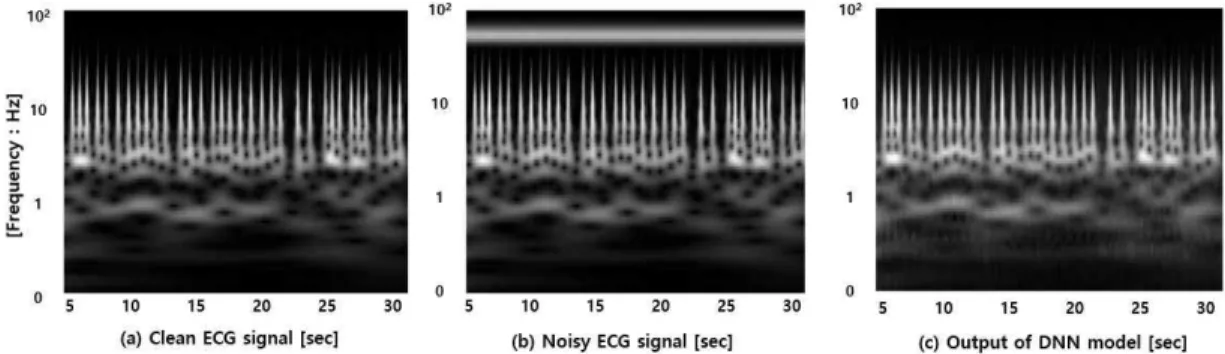 Fig. 7. The analysis of de-noising result with amplitude  coefficient 1 in inverse wavelet transform (a)  Clean ECG signal (b) Noisy ECG signal (c) De-  noised ECG signal.