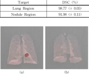Fig. 6. The evaluation of segmentation model using precision-recall curve. (a) Precision-recall curve of lung nodule  segmentation model
