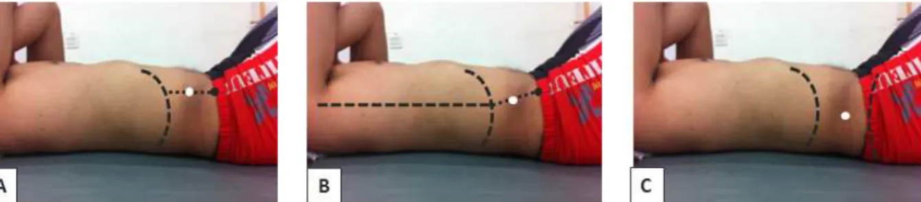 Figure 1. Three different probe locations. A: probe location 1 (PL1)-below the rib cage in direct vertical alignment with the anterior superior iliac spine (ASIS), B: probe location 2 (PL2)-halfway between the ASIS and the ribcage along the mid-axillary li