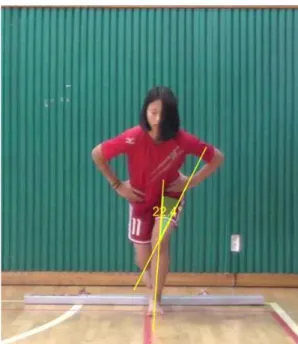 Figure 14. Single Leg Squat(Q-angle)