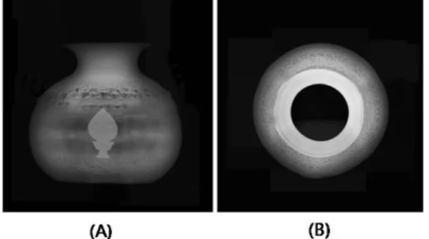 Figure 9. Contamination (A) and discoloration (B) on the surface.