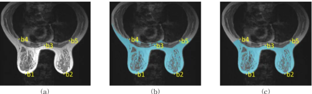 Fig. 4. Segmentation of breast region: (a) Select base points b1, b2 (the end points of both breasts), b3 (middle  point of breastbone), b4, b5 (the end points of the pectoral muscle), (b) Breast area selection by threshold  (blue color), (c) Final breast 