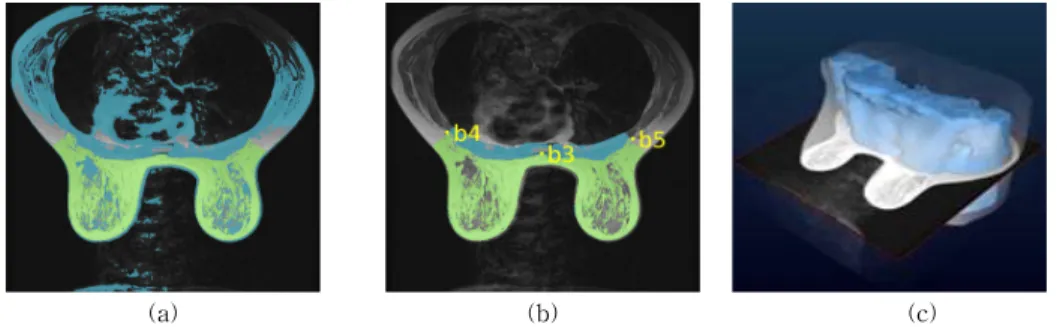 Fig. 5. Segmentation of the pectoralis major muscle region: (a) Select the pectoral muscle area by threshold (blue  color), (b) Subtract the breast area from the blue area and delete unnecessary parts based on b3 ~ b5,  (c) Visualization of the 3D model of
