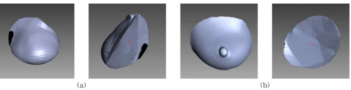 Fig. 12. Breast implant model created by Artec studio 12 : (a) Front view(left) and back view(right) of the model  generated from the input data in fig.3, (b) Front view(left) and back view(right) of the model generated  from other input data.