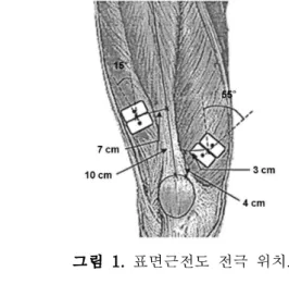 그림 1. 표면근전도 전극 위치. 에서 사용된 계단 도구는 양쪽에 계단 난간이 있는 높이 15 ㎝, 깊이 30 ㎝, 그리고 너비 75 ㎝의 계단을 이용하였다