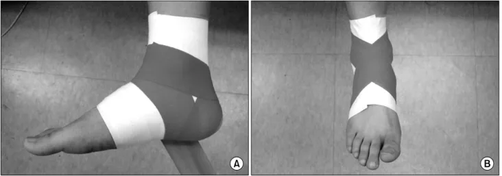 Fig.  2.  Ankle  taping  with  heel  lock  (A)  and  figure  of  8  (B)  technique.30분 운동 후 어느 정도 느슨해진 발목 테이핑에 의한 내반 각속도는 약 250o/s이므로,  테이핑에 의한 손상 예방 효과는 내반 각속도에 영향을 받으며,  비교적 낮은 각속도의 발목 전위에서 보다 효과적으로 작용할 것이다.5)  그러나 실제 점프 후 착지할 때 내반 각속도는 1,000o/s  이상이고 지면