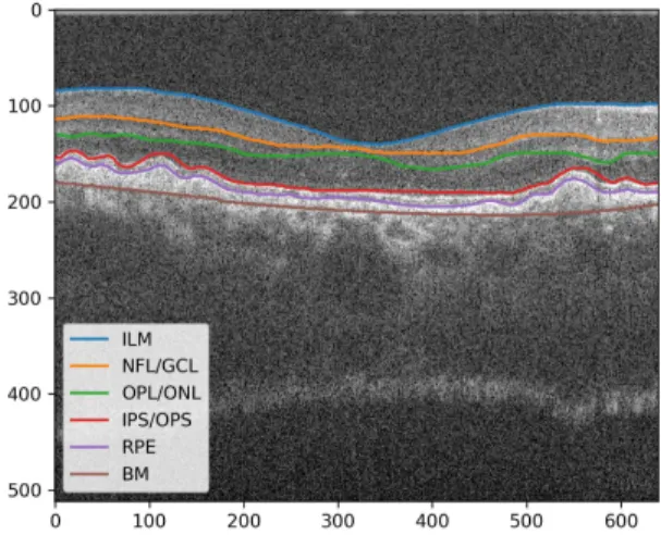 Fig. 3. Retinal layers.
