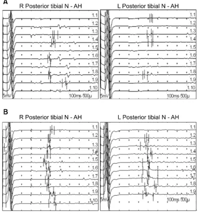 Fig.  2.  Brain  MRI  (A)  and  lumbar  spine  MRI  (B)  studies  do  not  show  a  lesion  relevant  to  bilateral   weak-ness  as  well  as  sensory  dysfunction  in  the  lower  extremities  of  the  patient
