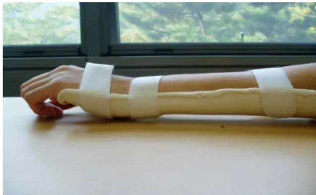 Figure 1. Wearing a wrist extension splint.