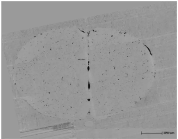 Fig. 3. A cross section of the mouse brain. The black  parts are vascular stained with India ink