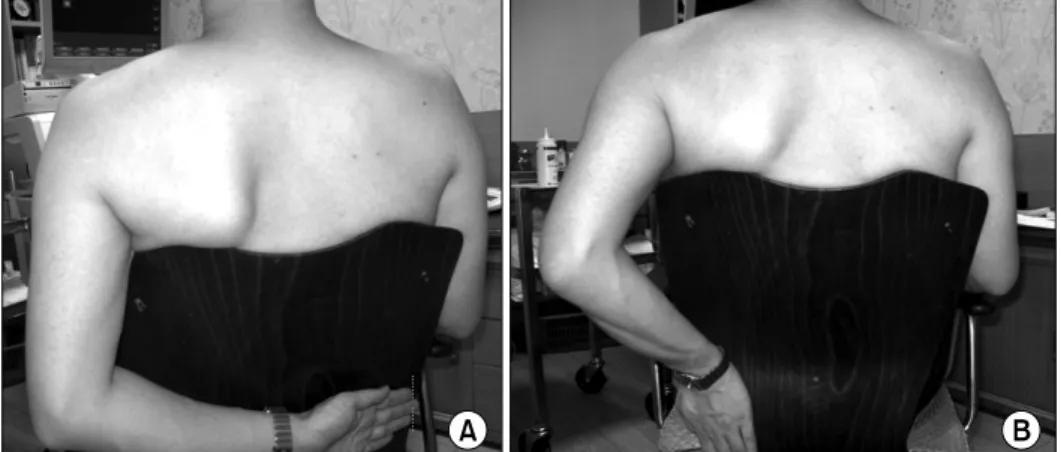 Fig.  9.  Position  for  supraspinatus  view.  (A)  Crass  position.  (B)   Mo-dified  Crass  position.