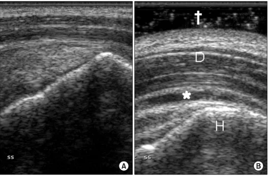 Fig.  13.  A  29  year  old  female  pa- pa-tient  with  chronic  shoulder  pain. 