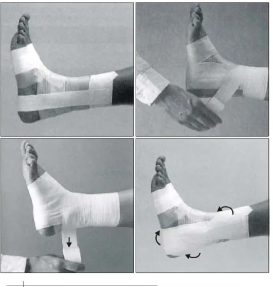Fig.  1.  Procedure  of  taping  for  prophylactic  ankle  sprains. 3)