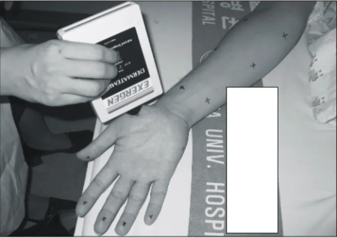 Fig.  1.  Skin  temperature  measurement  sites  of  forearm,  and  hand.