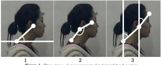 Figure 1. Three types of measurements for forward head posturewas recorded by a digital camera and video motion