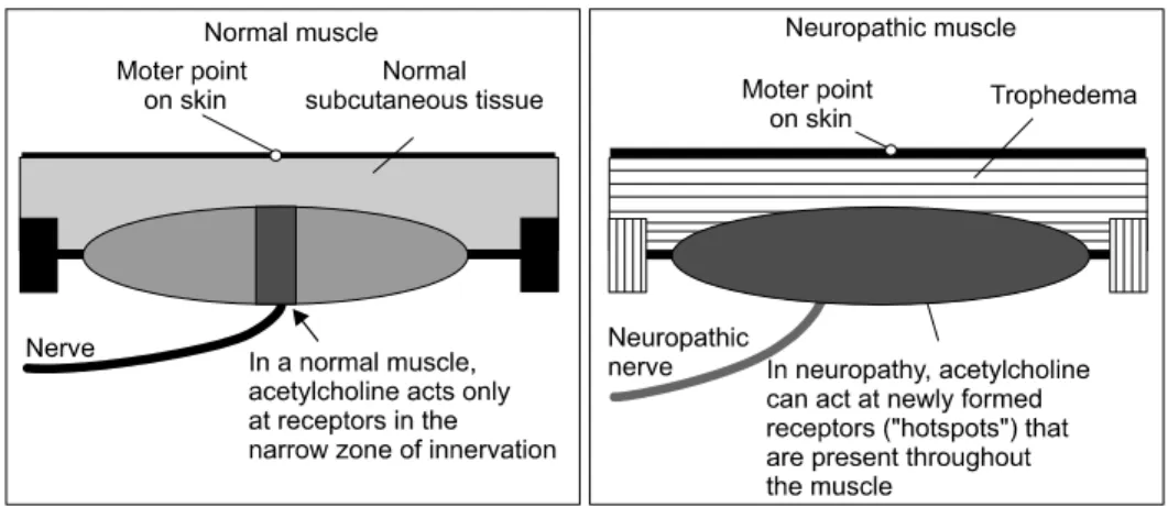 Fig.  2.  Response  of  neuropathic  muscle.