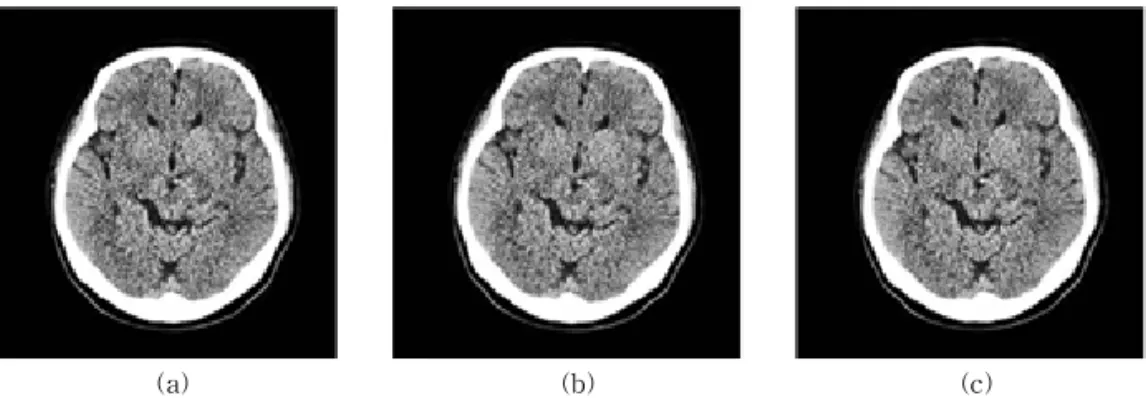 Fig. 4. (a) Preprocessed Image, (b) Rotation Right, (c) Rotation Left.