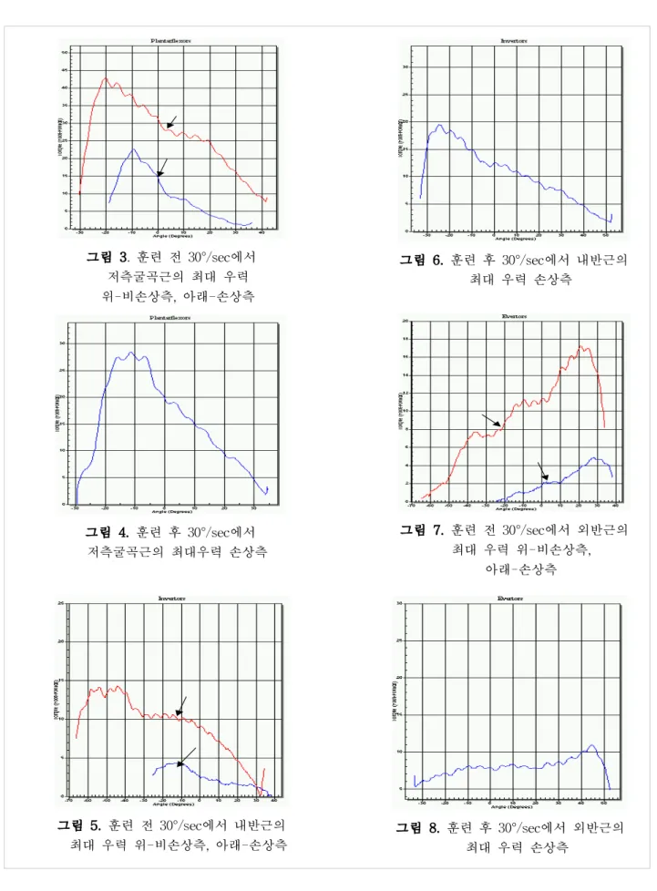 그림 4. 훈련 후 30°/sec에서 저측굴곡근의 최대우력 손상측 그림 7. 훈련 전 30°/sec에서 외반근의최대 우력 위-비손상측, 아래-손상측 그림 8