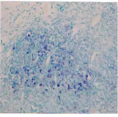 Figure 7. The mast cells around the granulation tissue on the 3rd day after incision