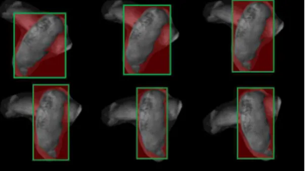 Fig. 6. Separation of occlusion using image processing  technique.