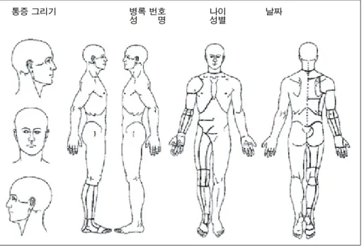 Fig.  2.  Picture  of  the  OMB Ⓡ .