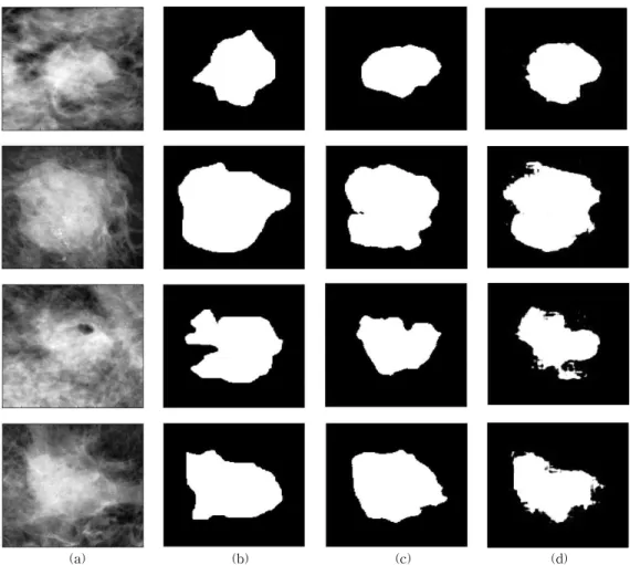 Fig. 3. Results of breast mass segmentation. (a) Original, (b) Gold standard, (c) Deconvolution net, (d) U-net.