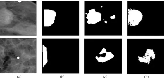 Fig. 6. Results that are not accurately segmented. (a) Original, (b) Gold standard, (c) Deconvolution net, (d) U-net.