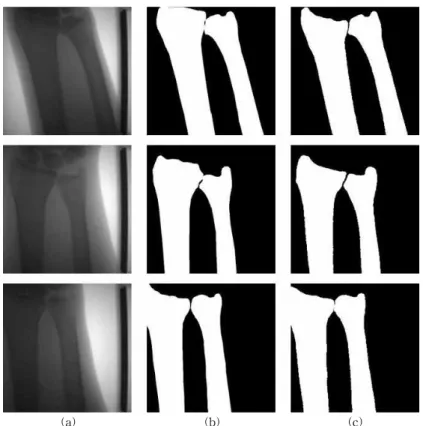 Fig. 5. Comparison of the segmentation results between the deep learning and manual. (a)original images, (b)manual  segmentation results, (c)deep learning segmentation results.