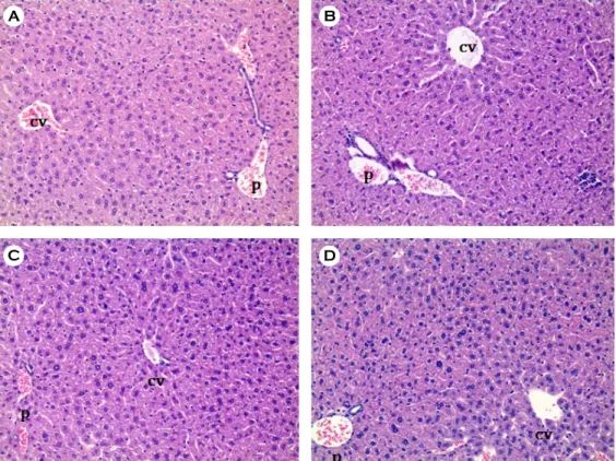 Fig. 3. Histology of  liver section. Mice were administered with saline, lovastatin (30 mg/kg), EGb 761 (25 mg/kg) or EGb 761 (50 mg/kg) for 40 days