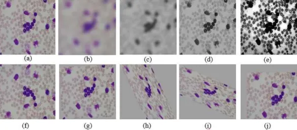 Fig. 2. Conventional data augmentation, (a) An original ALL image, (b) A blurring ALL image, (c) A blurring grayscale  image, (d) A grayscale image, (e) Histogram equalization, (f) Reflection image through x-axis, (g) Rotated  image, (h) Shearing image alo