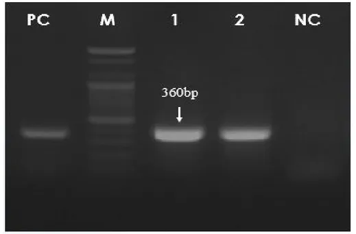Fig. 3. Agarose gel electrophoresis of RT-PCR product for BVDV type 1. Specific band showed at 360 bp
