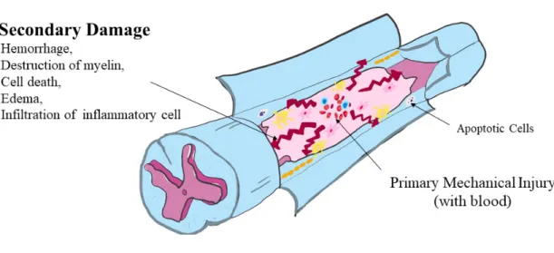 Figure 2. Schematic illustrations of both mechanical and inflammatory 