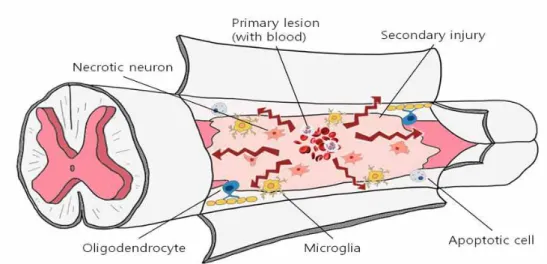 Figure  3.  Schematic  illustrations  of  both  mechanical  and  inflammatory 