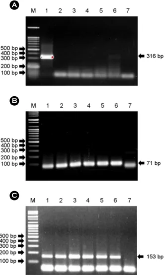 Fig. 1. GAPDH RT-PCR with formalin fixed paraffin embedded (FFPE) tissues from diffuse large B cell lymphoma (DLBCL)  patient