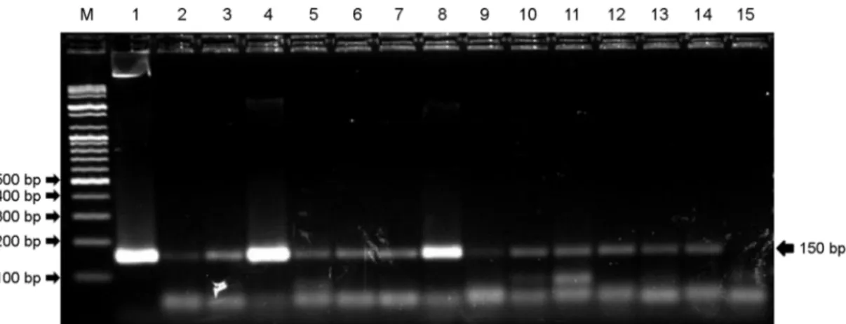 Fig. 2. RT-PCR of Epstein-Barr virus encoded small RNA (EBER) with formalin fixed paraffin embedded (FFPE) tissues from  DLBCL patients