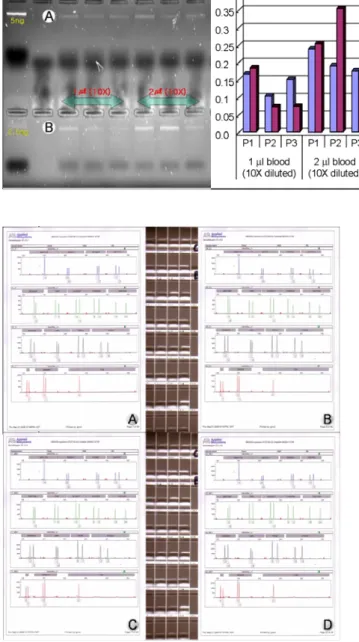 Fig. 2. Agarose gel electrophoresis and  real-time quantitative PCR results of  DNA  isolated from 10× diluted bloodstains by  manual DNA preparation