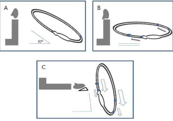 Figure 4. Thirty degree head flexion from pitch plane before the  lying down test(A,B) in right HSC-BPV