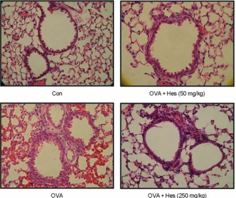 Fig. 4. Effect of hesperidin on airway responsiveness in OVA- OVA-sensitized and OVA-challenged mice