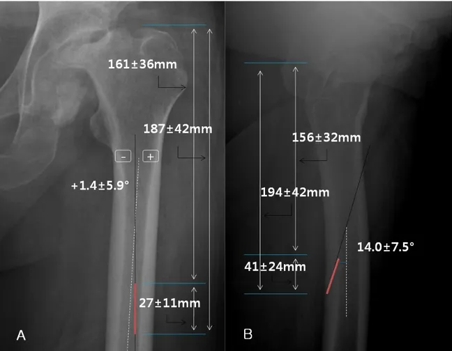 Figure 7. Post-operative radiological measurement by location of the nutrient artery canal (red  line)