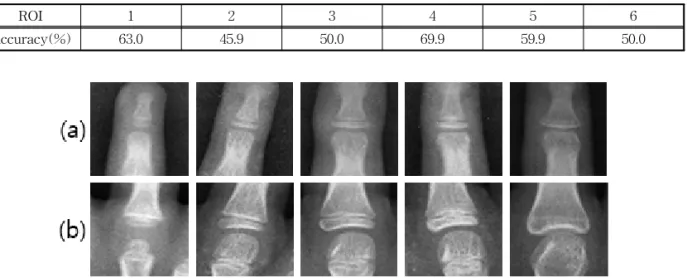 Fig. 7. Skeletal change according to each age group (a) ROI 2(Middle finger last node), (b) ROI 4(Middle finger  first node)