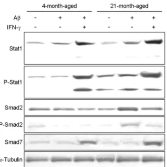 Fig. 3. Inhibited production of TGF-β expression in aged mice upon stimulation with IFN-γ