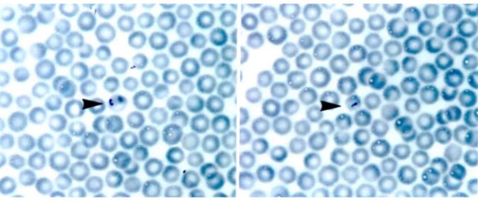 Figure  1.  Intraerythrocytic  forms  of  piroplasms.  Piroplasms  are  indicated  with  arrow